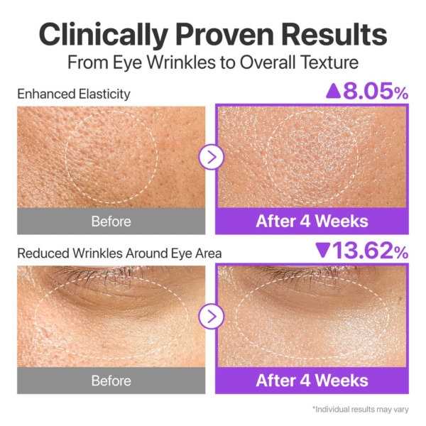 نتائج سيروم نمبوزين 9 قبل وبعد